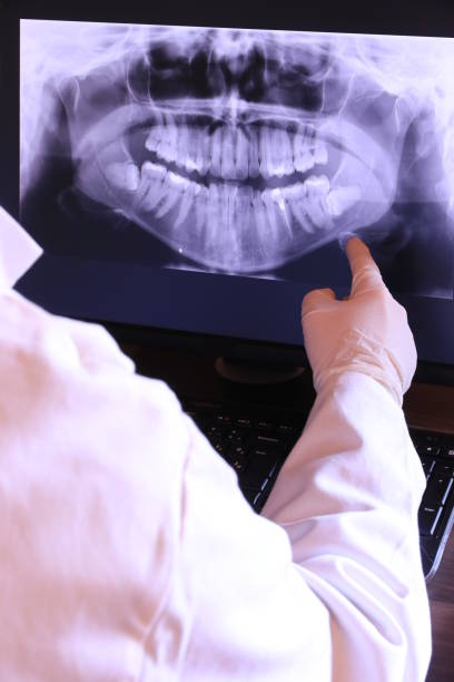 Best Emergency Wisdom Teeth Removal in Raleigh, NC